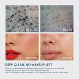 Total Cleansing Set